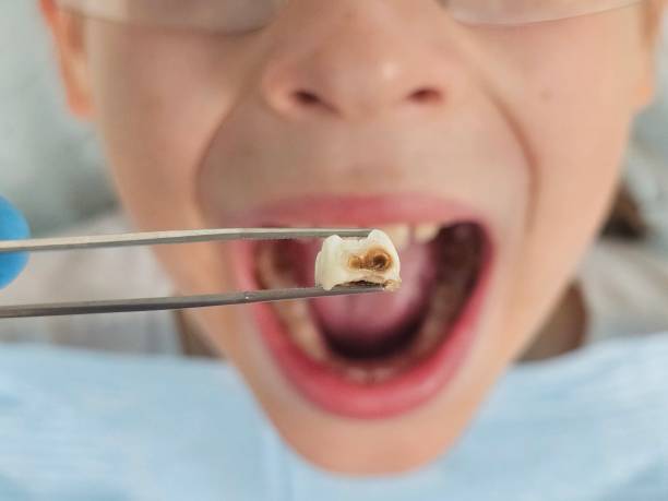 Best Mobile Emergency Dentist in Lubeck, WV