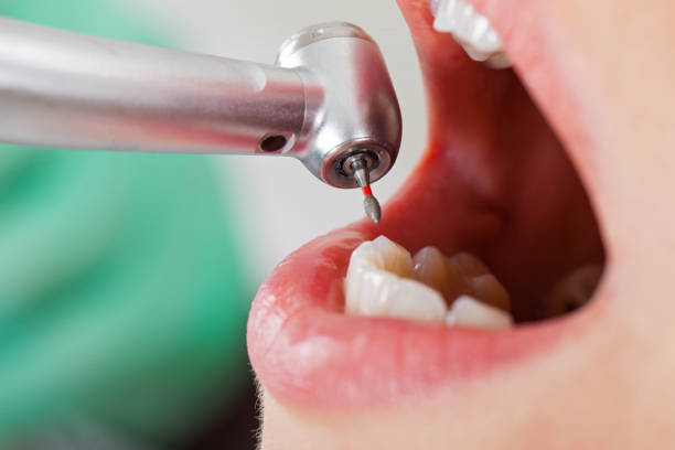 Best Weekend Emergency Dentist in Lubeck, WV